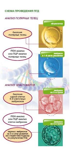 Преимплантационная генетическая диагностика (ПГД) в Новокузнецке