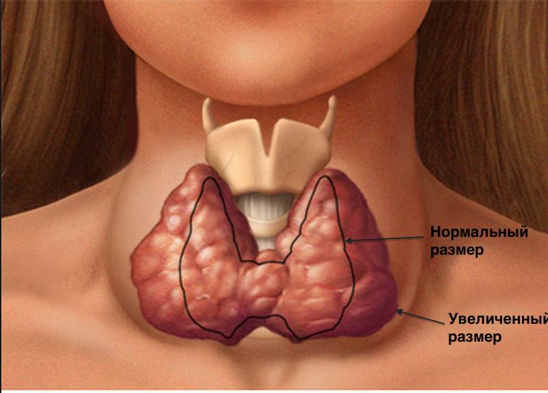 щитовидная железа.jpg